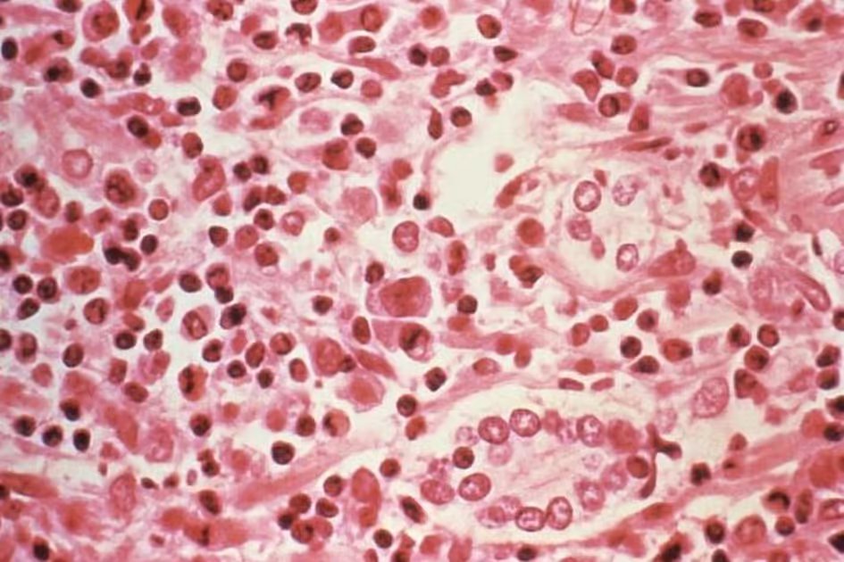 ‘Not another Covid-19’: UAE doctors allay hantavirus fears, explain low spread risk
