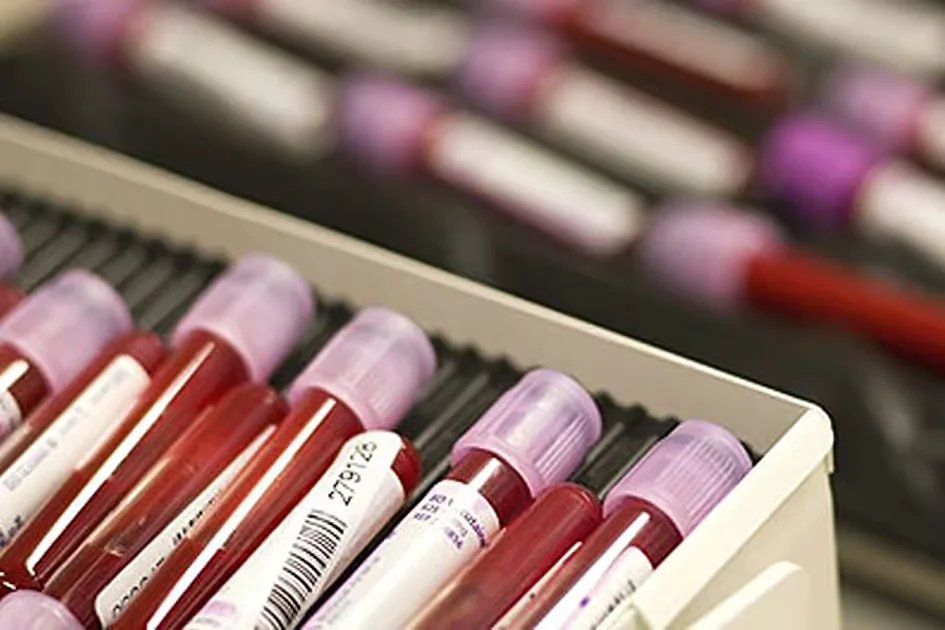 Could managing diabetes help slow Alzheimer’s? Dubai study to track key biomarker